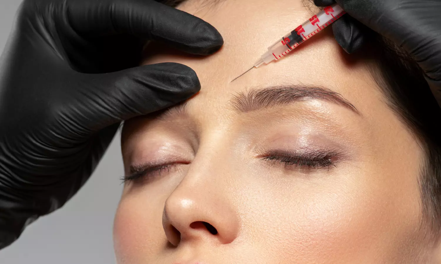 20 or 40 Units of Botox for Fine Lines & Wrinkles